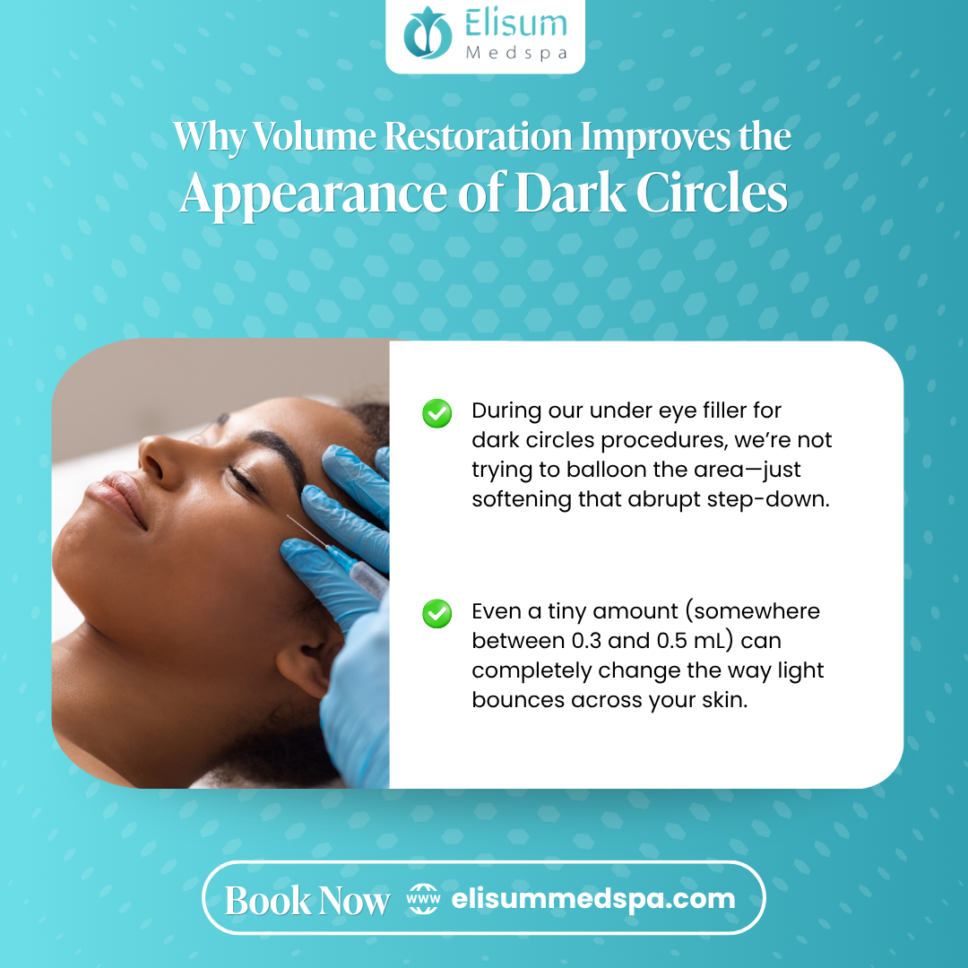 Why Volume Restoration Improves the Appearance of Dark Circles.
