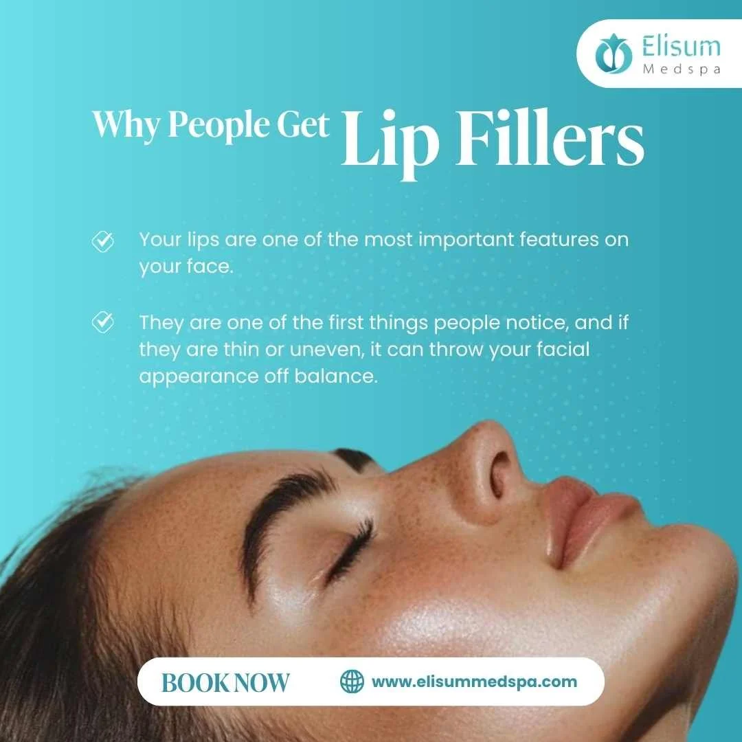 Why People Get Lip Fillers