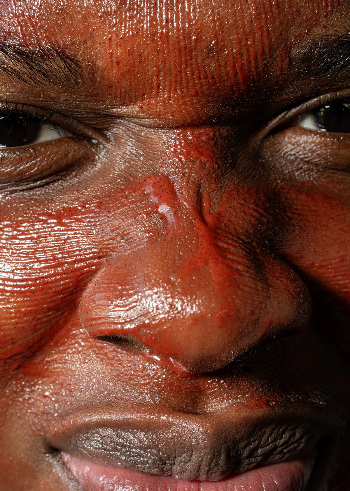 Close-up of a person's face with scraped, bloodied skin and tears near the eyes and nose.