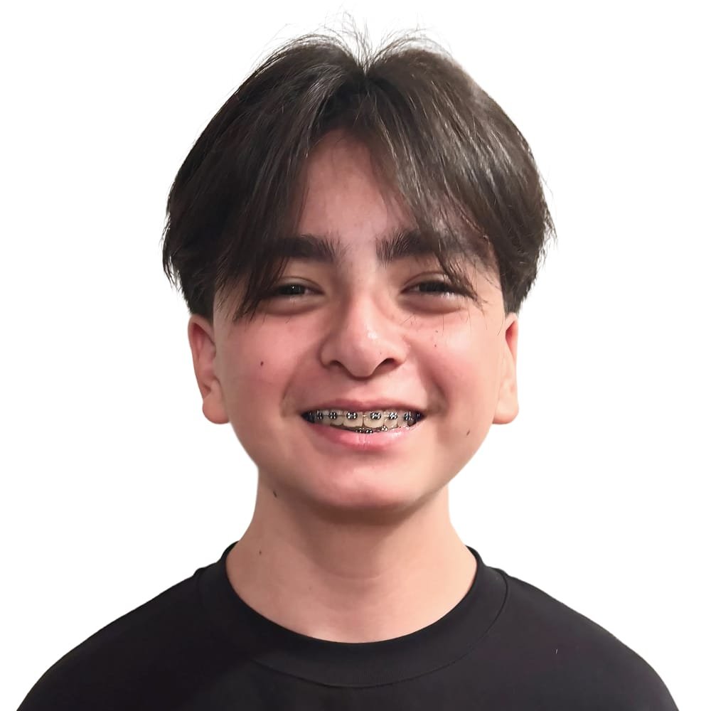A young person with dark hair, braces, and a black shirt smiling against a white background.