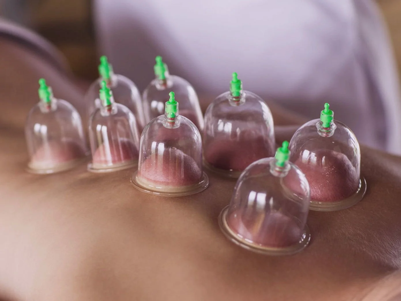 Cupping Questions Answered