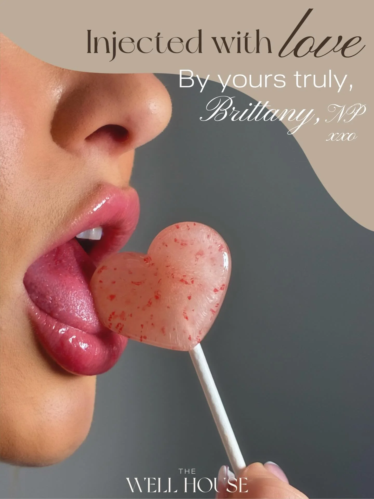 ✨Will never be over these lips OR this photoshoot 🍭💗

This lip enhancement was all about precision over volume &mdash; minimal filler, intentional placement, and skilled execution. 

Designed to create:
&bull;defined borders
&bull;natural pout
&bul