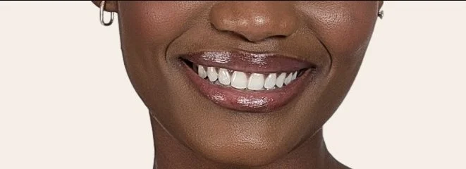 Hilary Biaku | Black Female Model, Creative Strategist, Content Creator, Public Speaker, and Life Coach —  Close-up of a smiling woman with glossy lips and white teeth, showing only her mouth and part of her face.