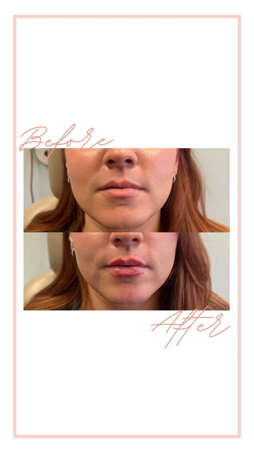 Before $ After's - SFPS (Instagram Story).jpg