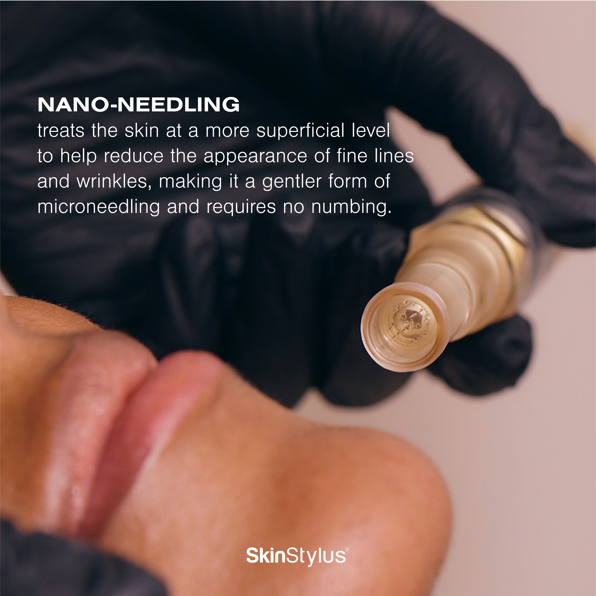 Nano-needling process creating micro-channels for skin absorption