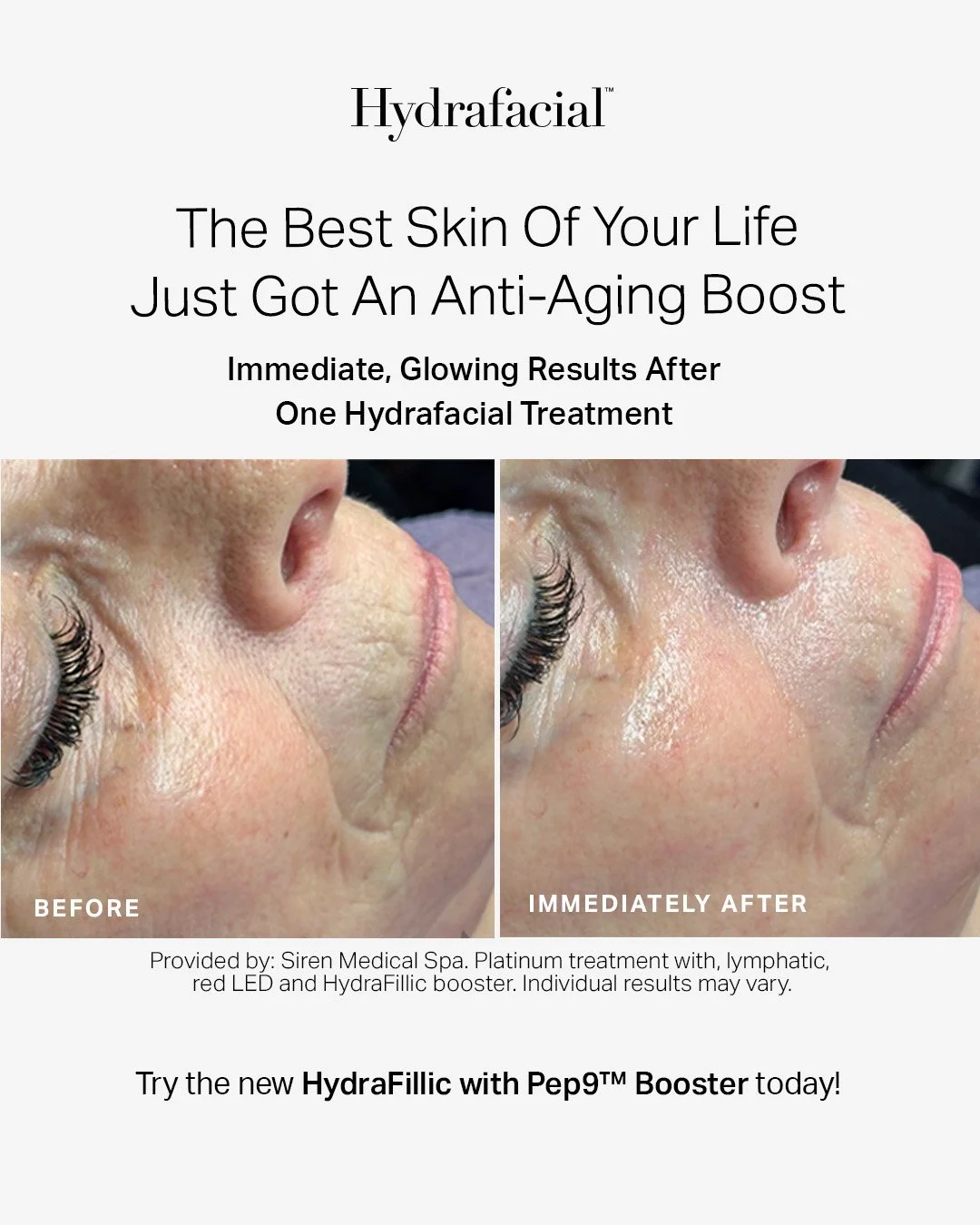 2025_HydraFillic_PTK_4x5_Anti-Aging2 (1).jpg