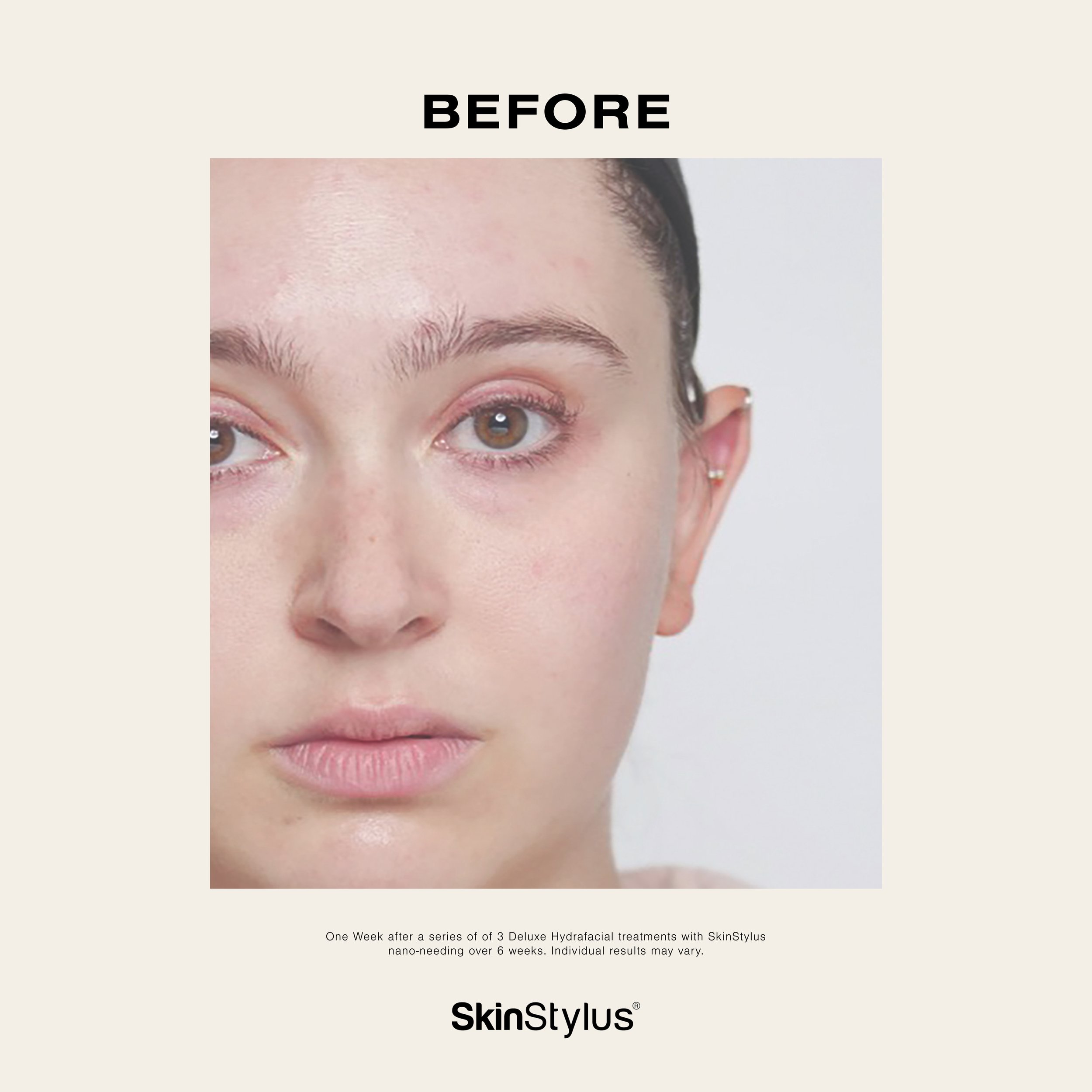 SS Nano B A Feed Post 3_1.jpg