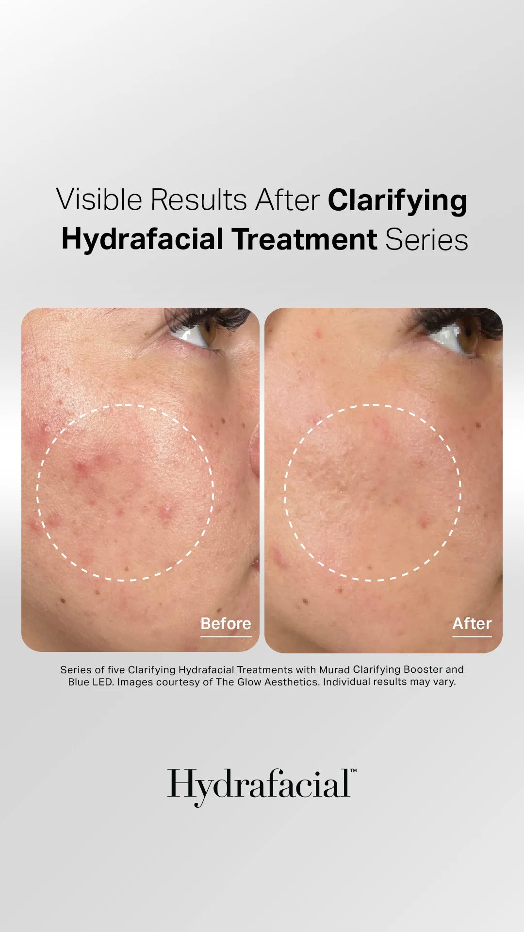 Clarifying Treatment Plan under Package 1 (1).jpg