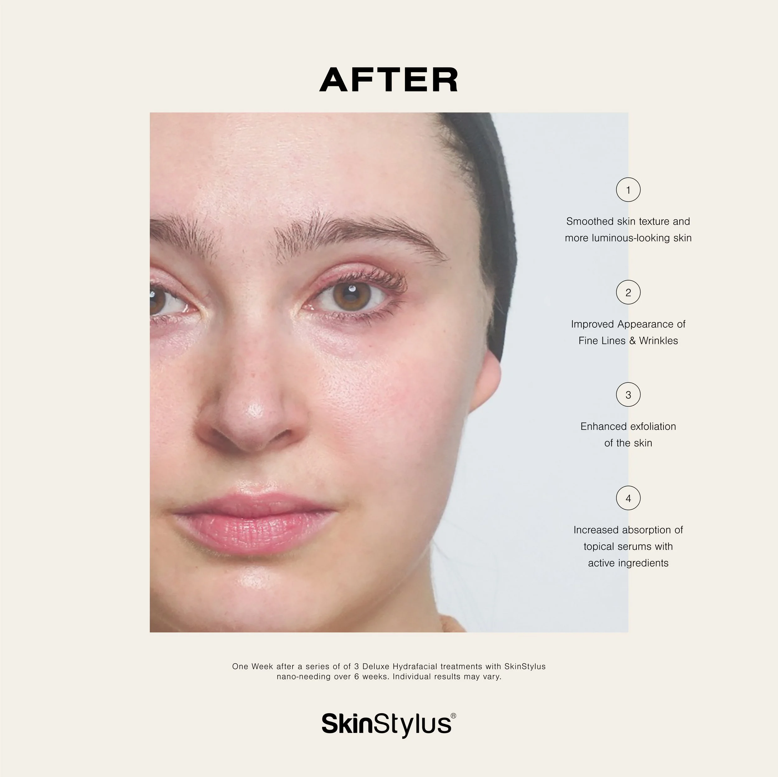 SS Nano B A Feed Post 3_2.jpg