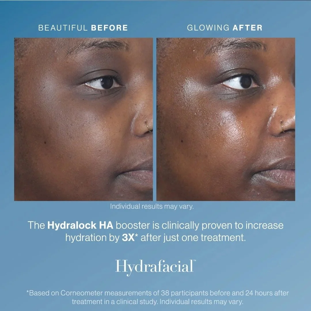 imgi_162_Hydralock_Before_After_1.jpg
