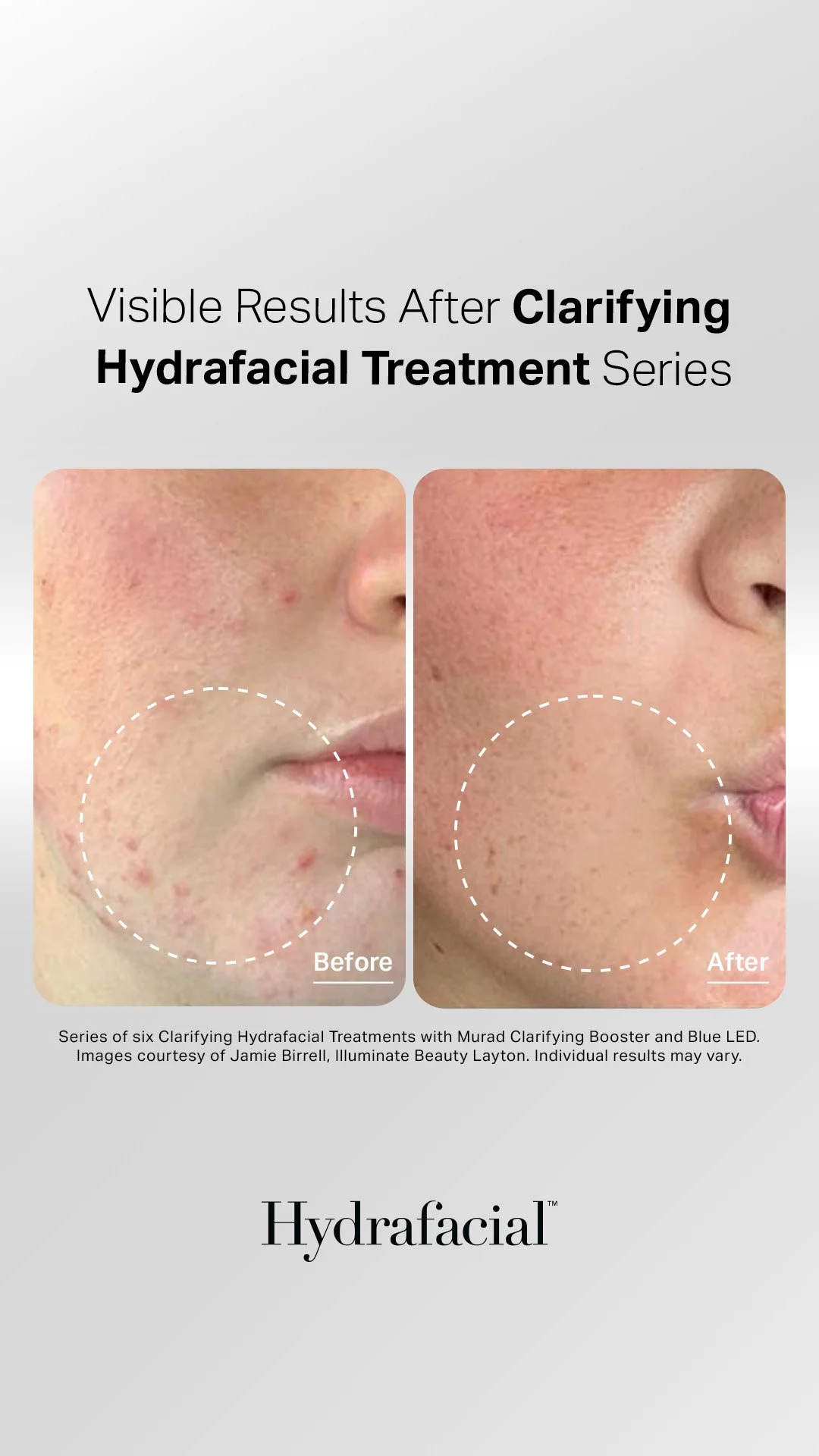 Clarifying Treatment Plan under package 2 (1).jpg