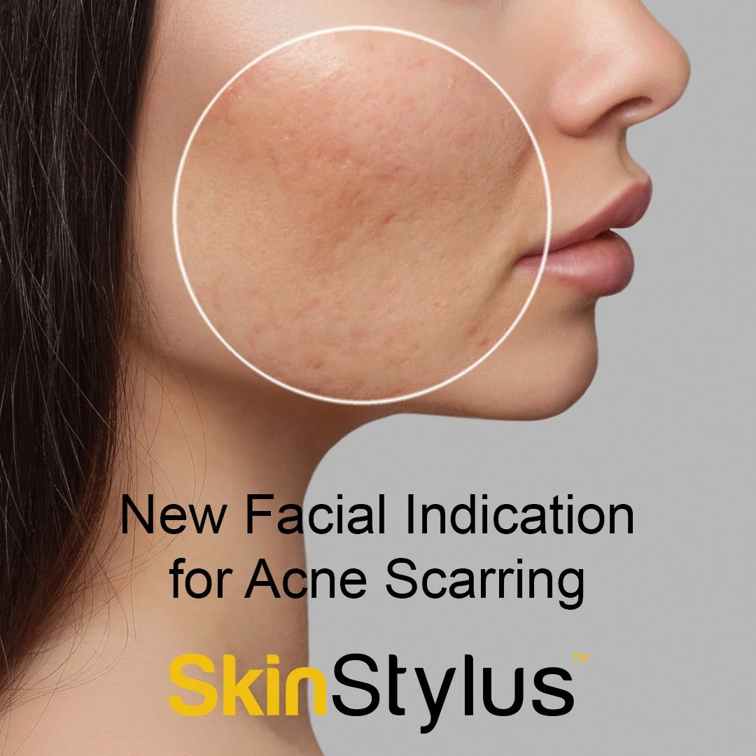 SkinStylus_New_Indication_IGFEED_1.jpg