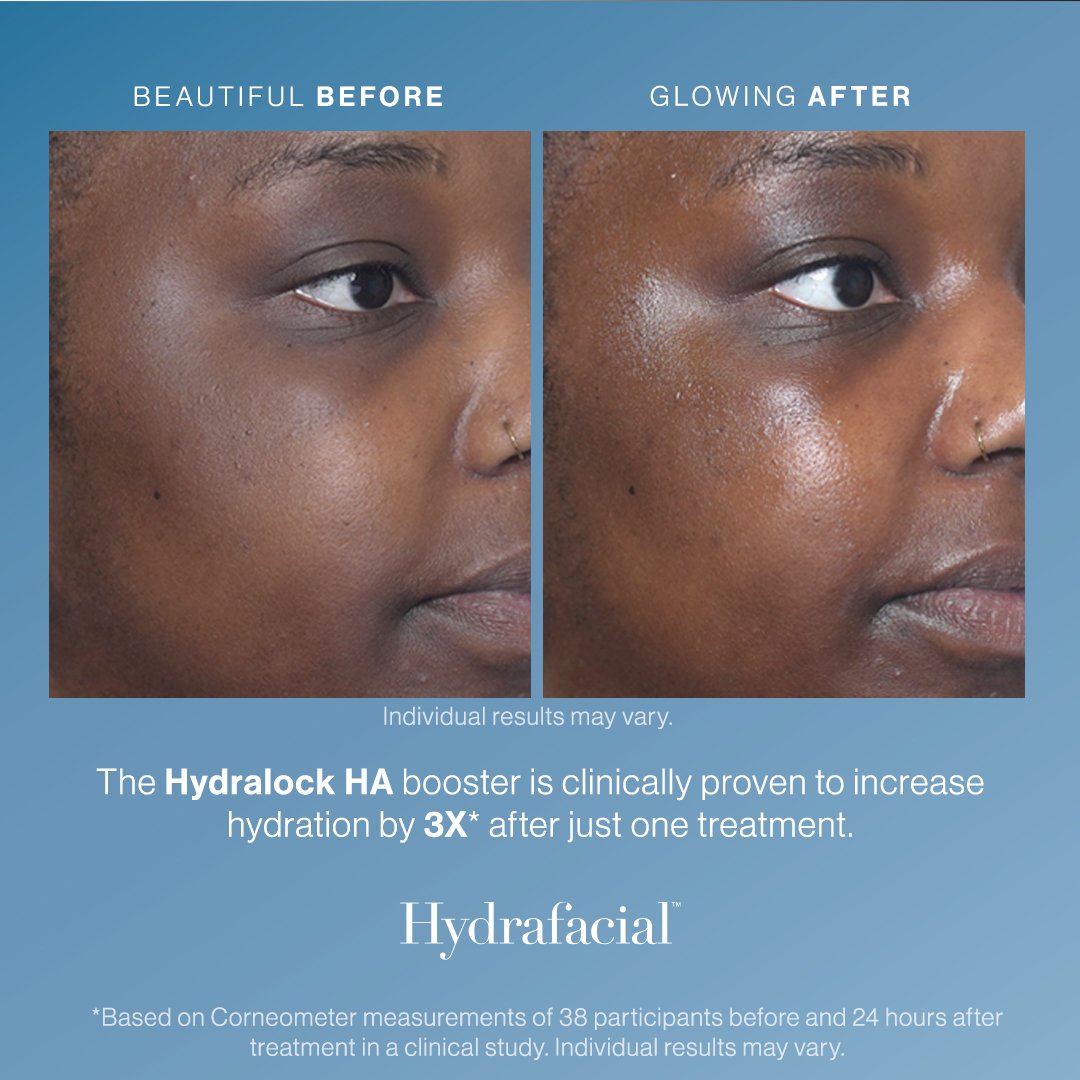 Hydralock_Before_After_1.jpg