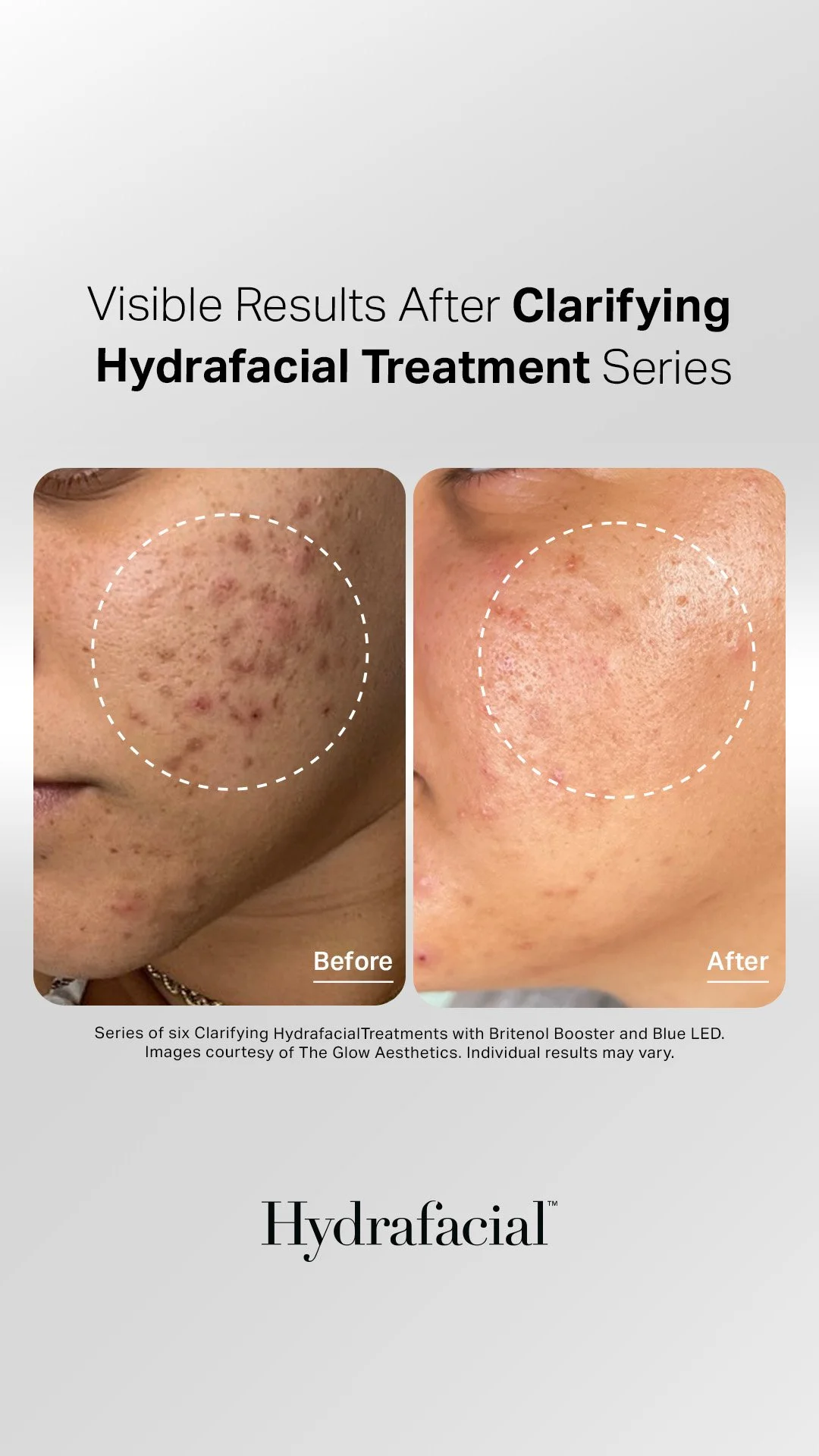 Clarifying Treatment Plan under package 3 (1).jpg