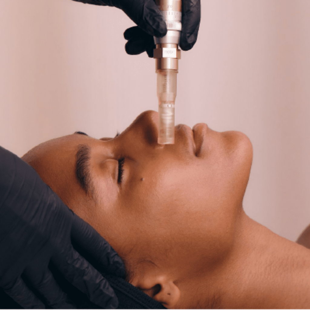 Hydraneedling treatment combining Hydrafacial and nano-needling at Spa Éclat