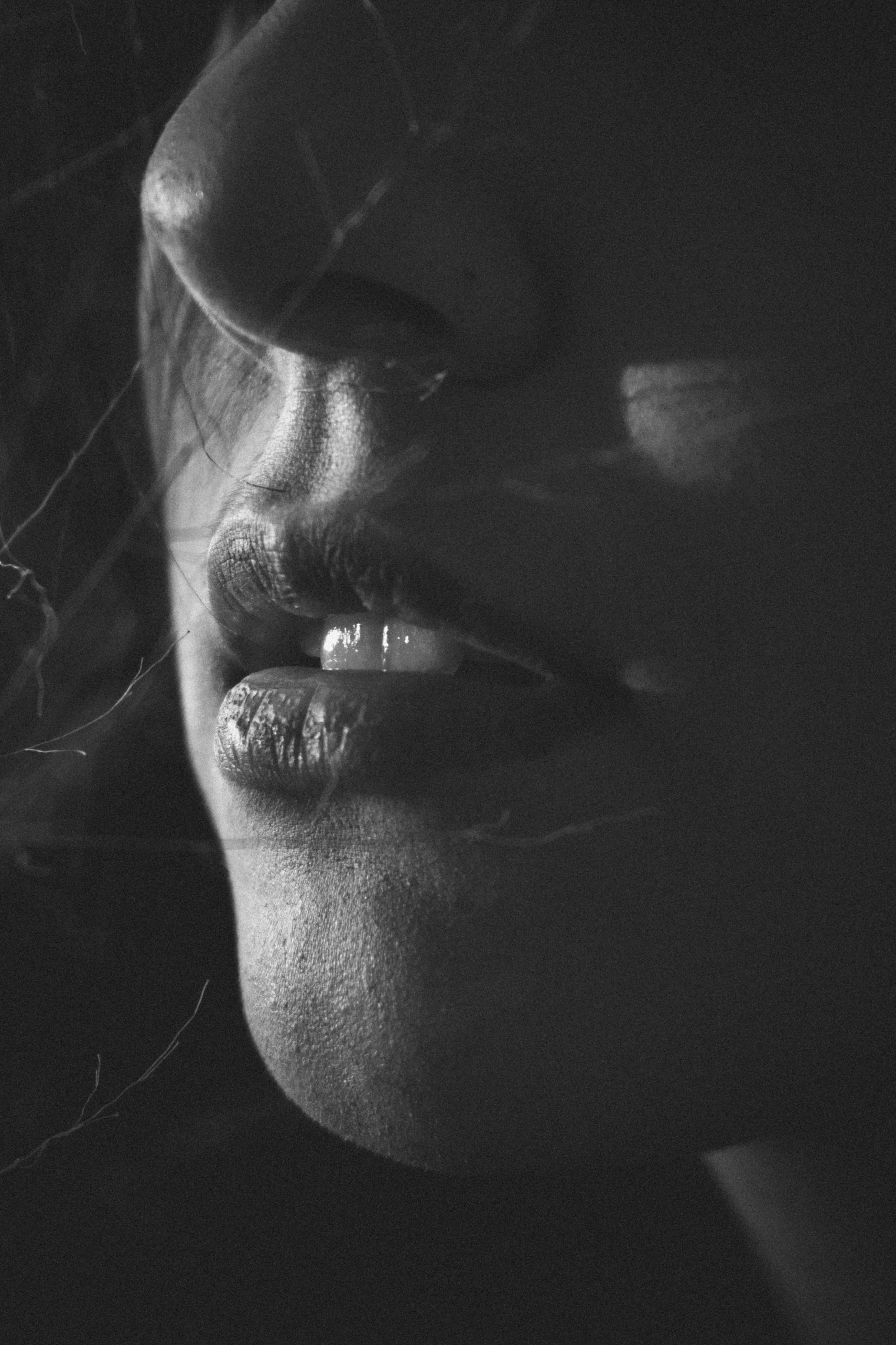 FLORA™ Buccal (Intra-oral)