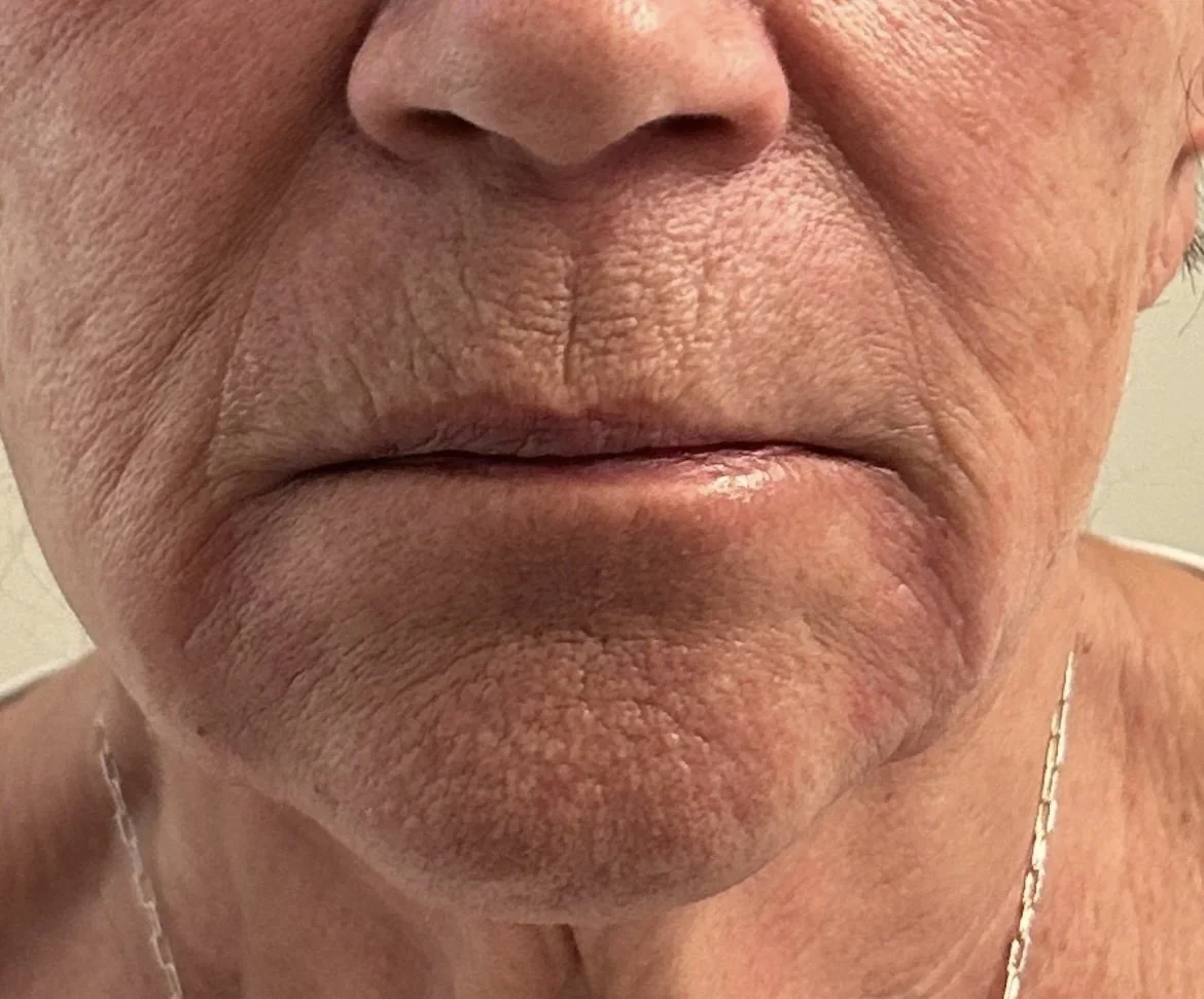 Close-up of the lower part of an older person's face, showing wrinkled skin, lips, and part of the chin.