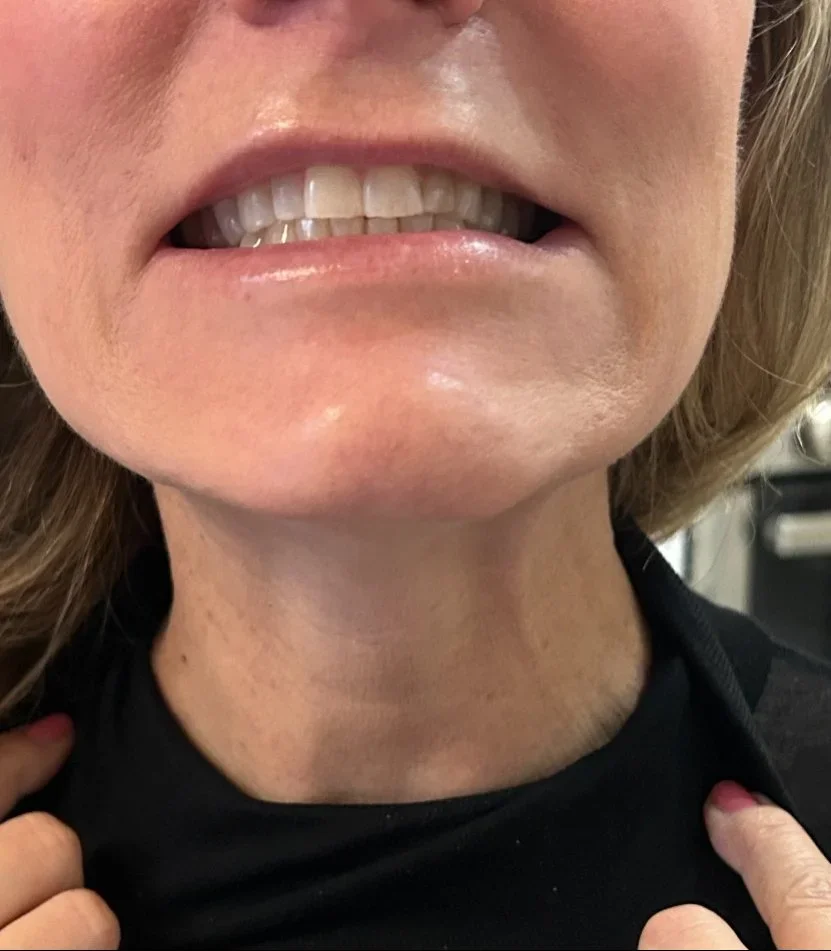 Close-up of a woman biting her lower lip, showing her teeth and part of her neck and chin.