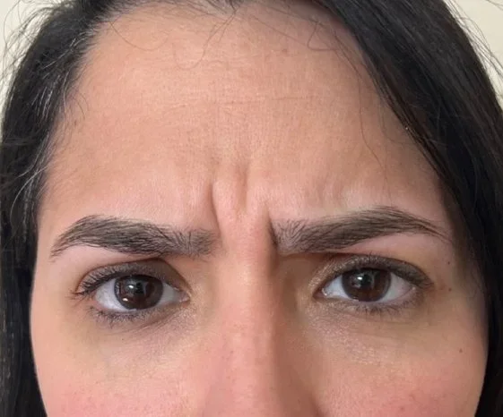 Close-up of a woman with furrowed brows and a serious or confused expression.