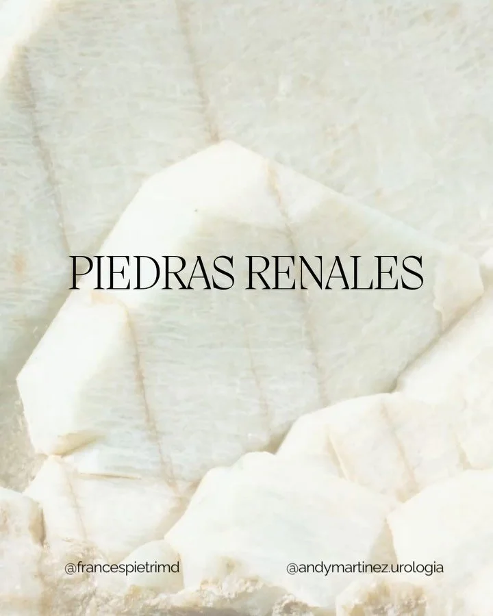 🪨 Los c&aacute;lculos o piedras renales son una condici&oacute;n frecuente y muy dolorosa, pero en muchos casos se pueden prevenir.

Desliza ➡️ el post para conocer:
 &bull; Por qu&eacute; se forman
 &bull; Cu&aacute;les son los s&iacute;ntomas de a