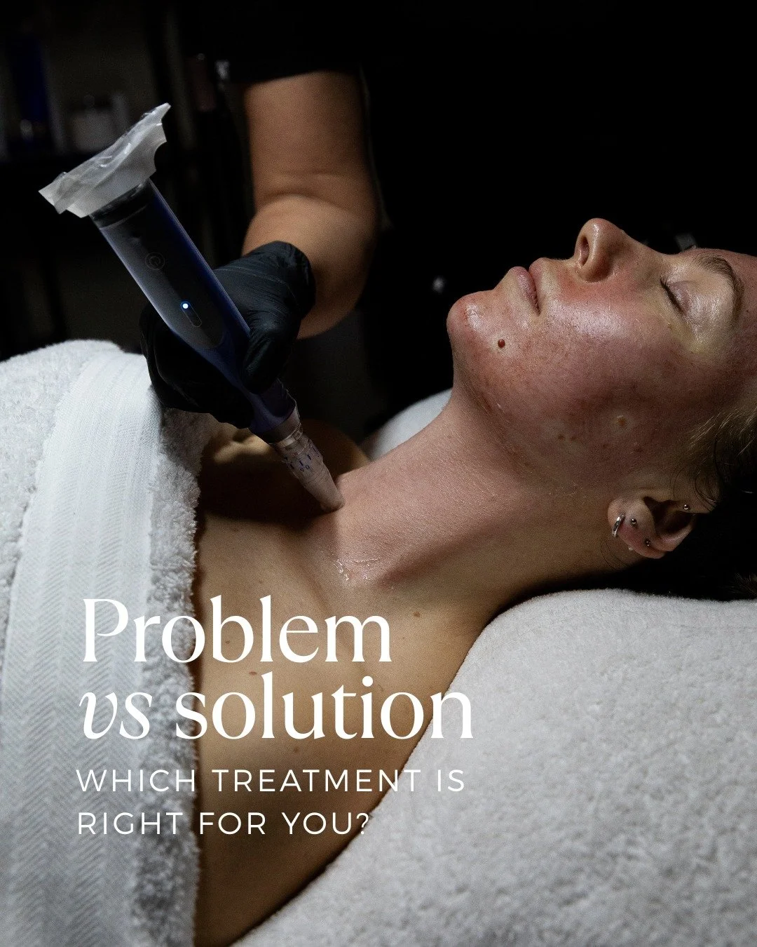 So many of the skin concerns I see in clinic start with the same feeling: &ldquo;I don&rsquo;t know what else to try.&rdquo;

You might be dealing with breakouts that won&rsquo;t settle, dryness that keeps coming back, pigmentation that won&rsquo;t f