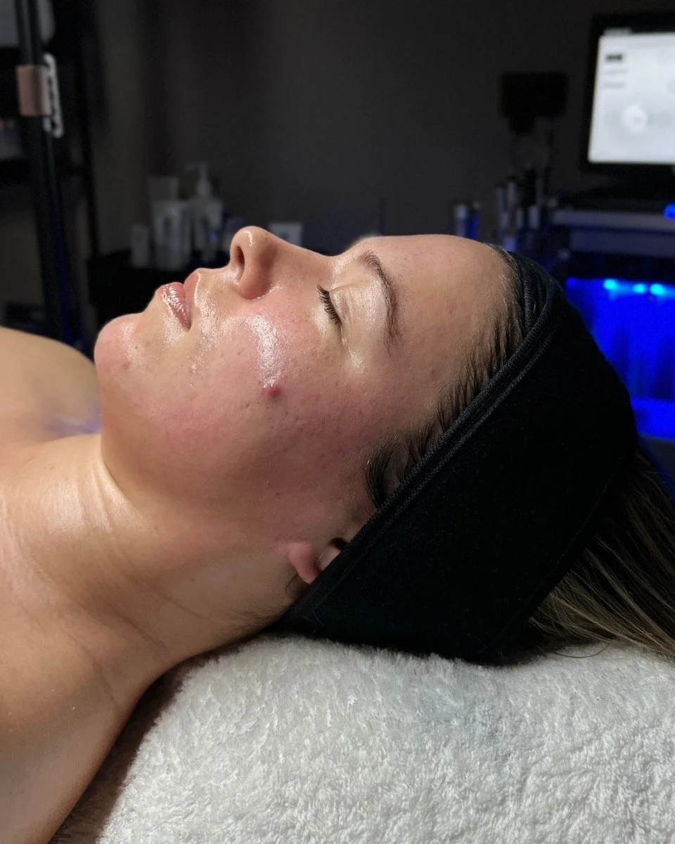 A woman receiving a facial treatment while lying down with her eyes closed, wearing a black headband in a spa or skincare clinic.