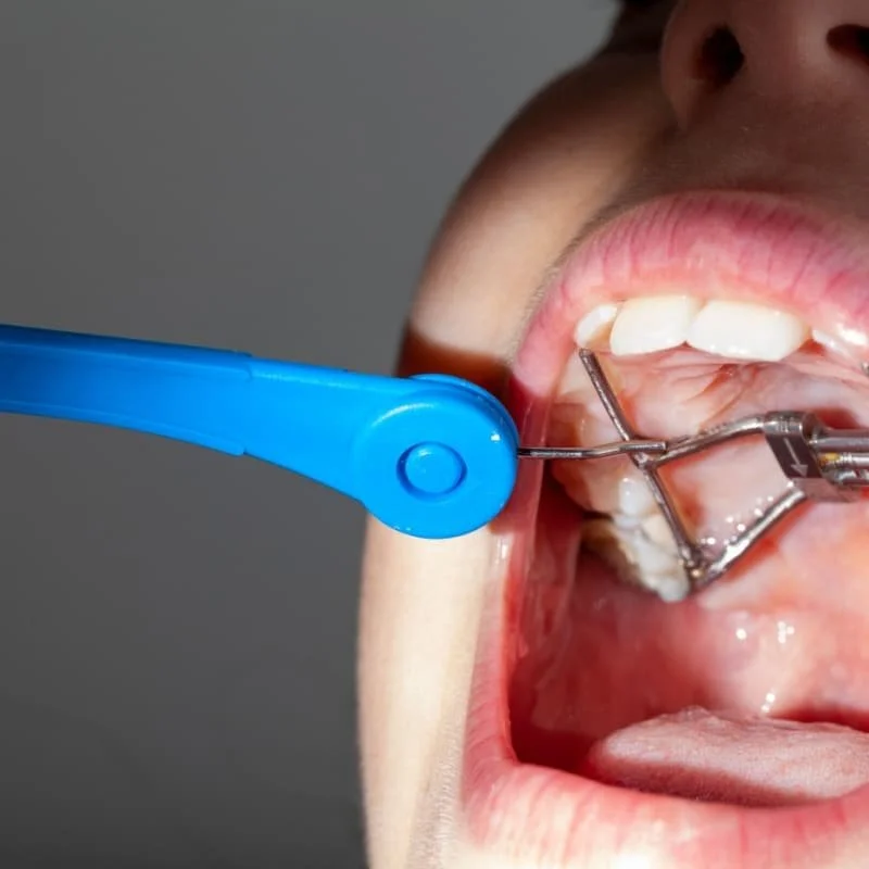 Close-up of a person getting a dental cleaning with a dental scaler and suction tool in their open mouth.