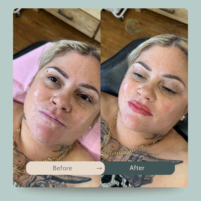 Lip Tattoo.png