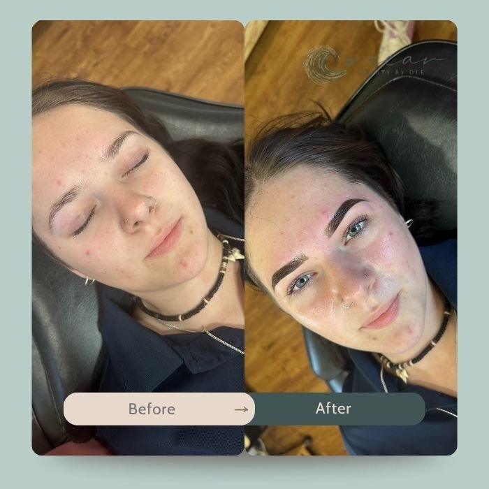 brow-lamination-3.jpg