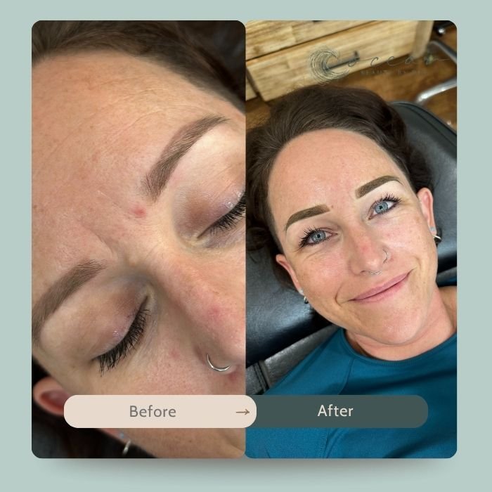 brow-lamination-7.jpg