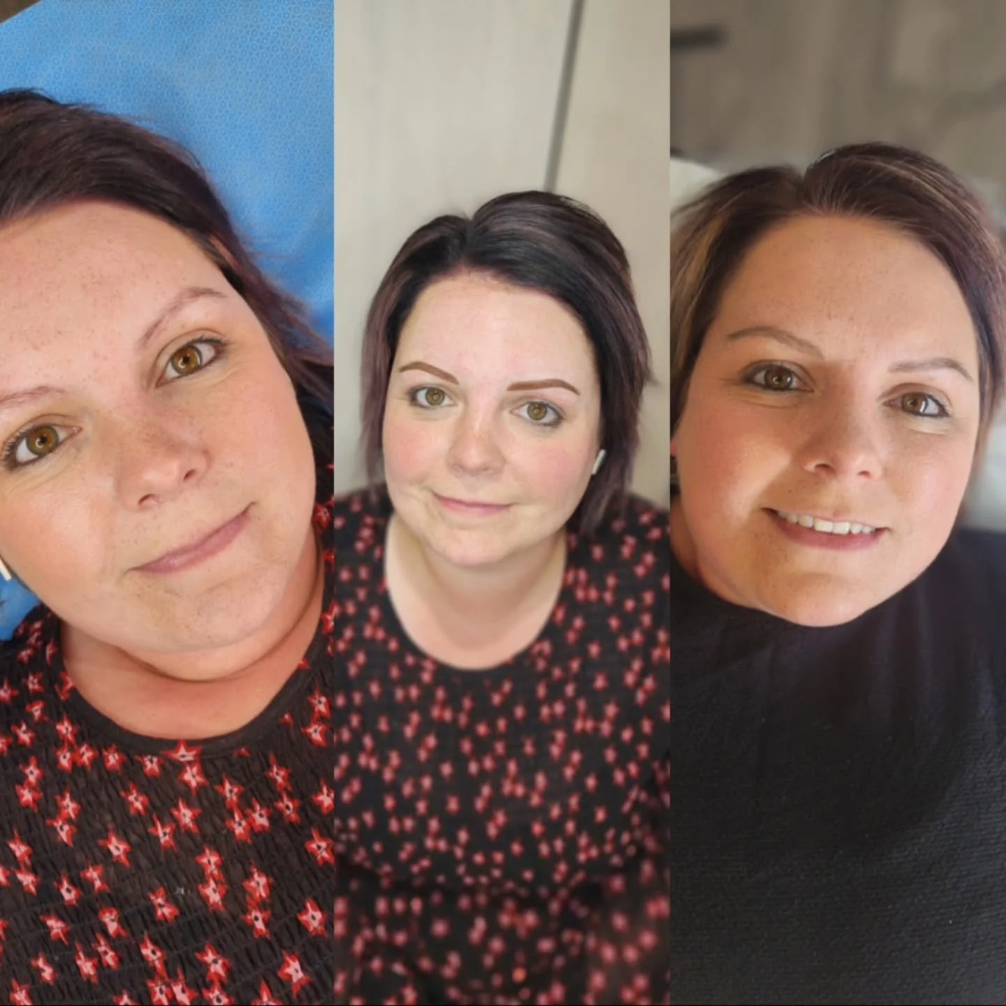 🔥 Before,  Straight After Cosmetic Tattoo &amp; healed 🙌

🔥 Taking Cosmetic Tattoo bookings again from beginning of March team! Summer is extremely busy in full wedding swing 😍 
DM to secure your spot x

#balcluthacosmetictattoo #balcluthabrows #