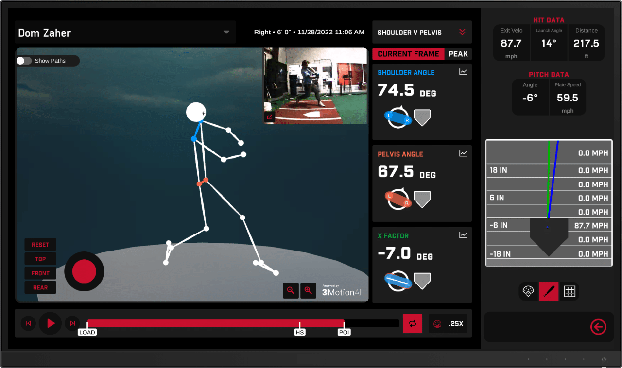 Biomechanic Assessment