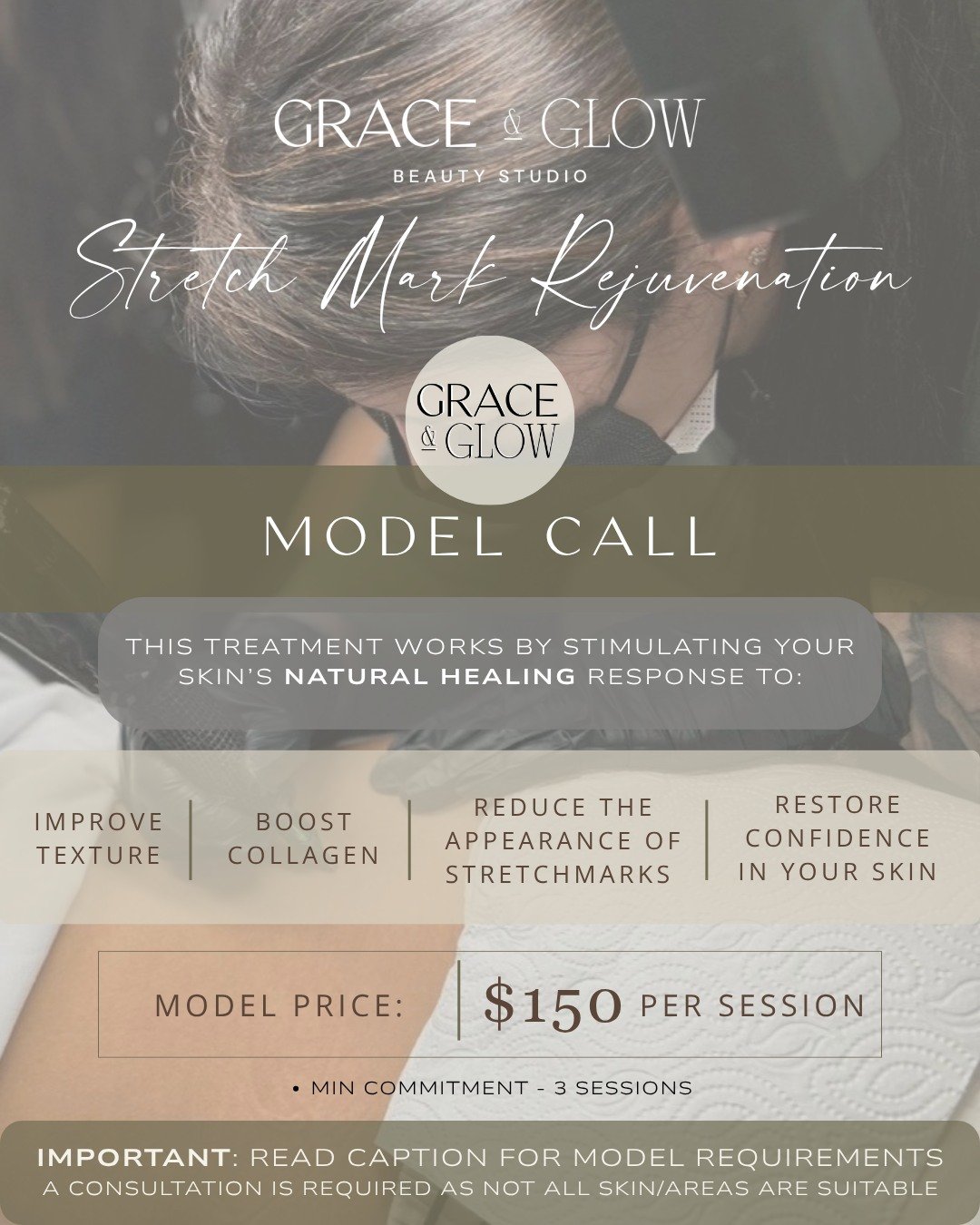 MODEL CALL &mdash; STRETCH MARK REJUVENATION 🤍

Grace &amp; Glow is opening a small number of model positions for Stretch Mark Rejuvenation as I begin building my portfolio.

This gentle restorative treatment works by stimulating your skin&rsquo;s n