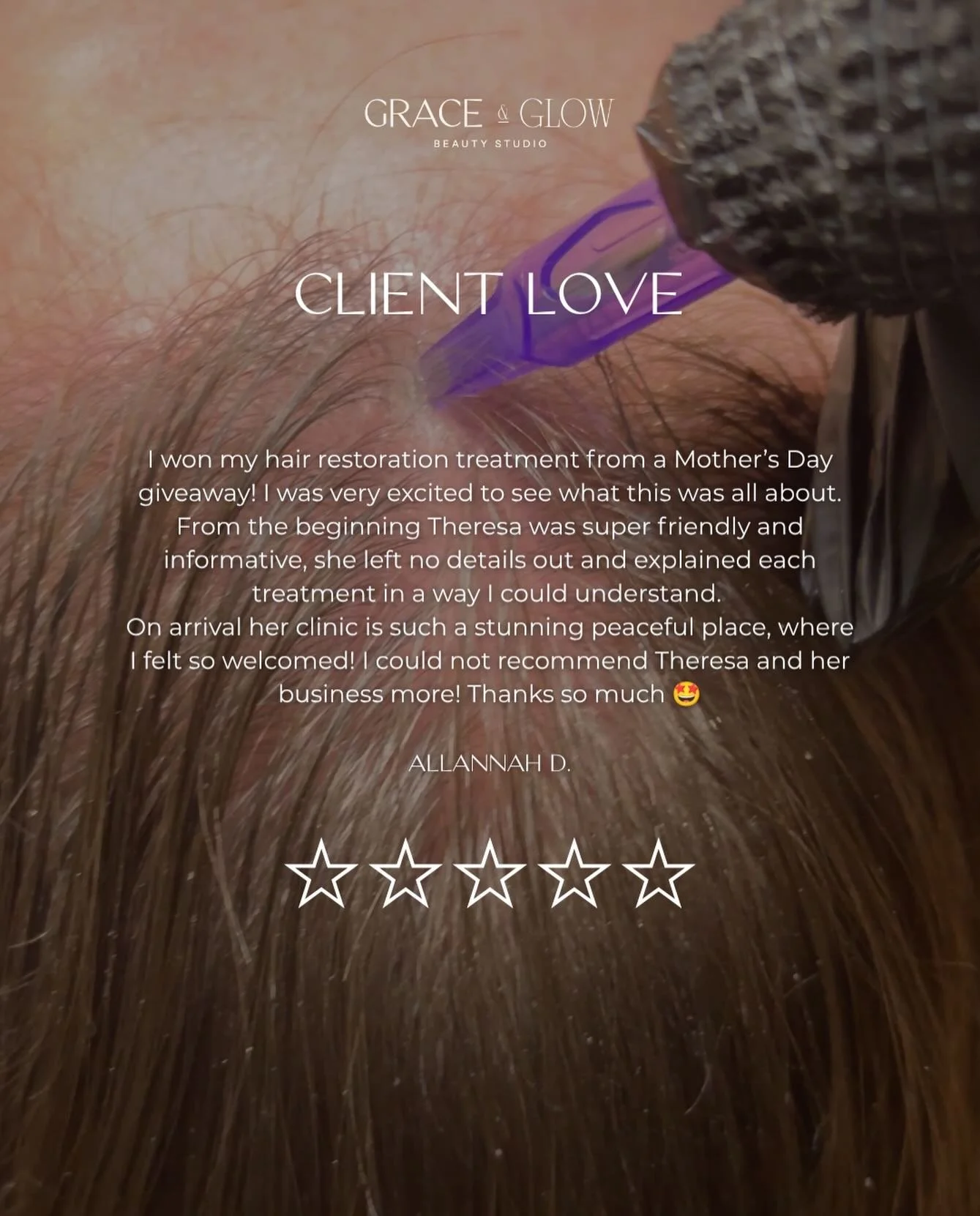 Reviews like this are everything 🤎

Knowing a client has felt cared for, supported and confident in their journey makes it all worthwhile.

Thank you for trusting me with your hair restoration treatment and for allowing me to be part of your journey