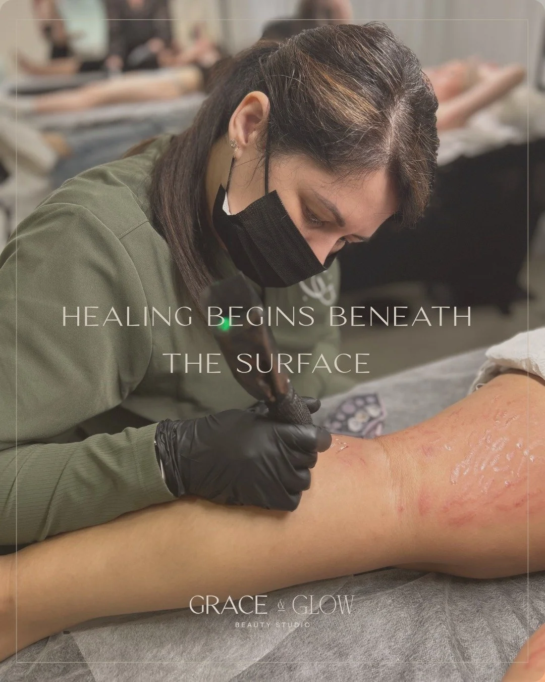 Healing doesn&rsquo;t always show up straight away &mdash;
but that doesn&rsquo;t mean it isn&rsquo;t happening.

Beneath the surface, your skin is already responding, rebuilding, renewing and working in its own time.

Through gentle micro-stimulatio