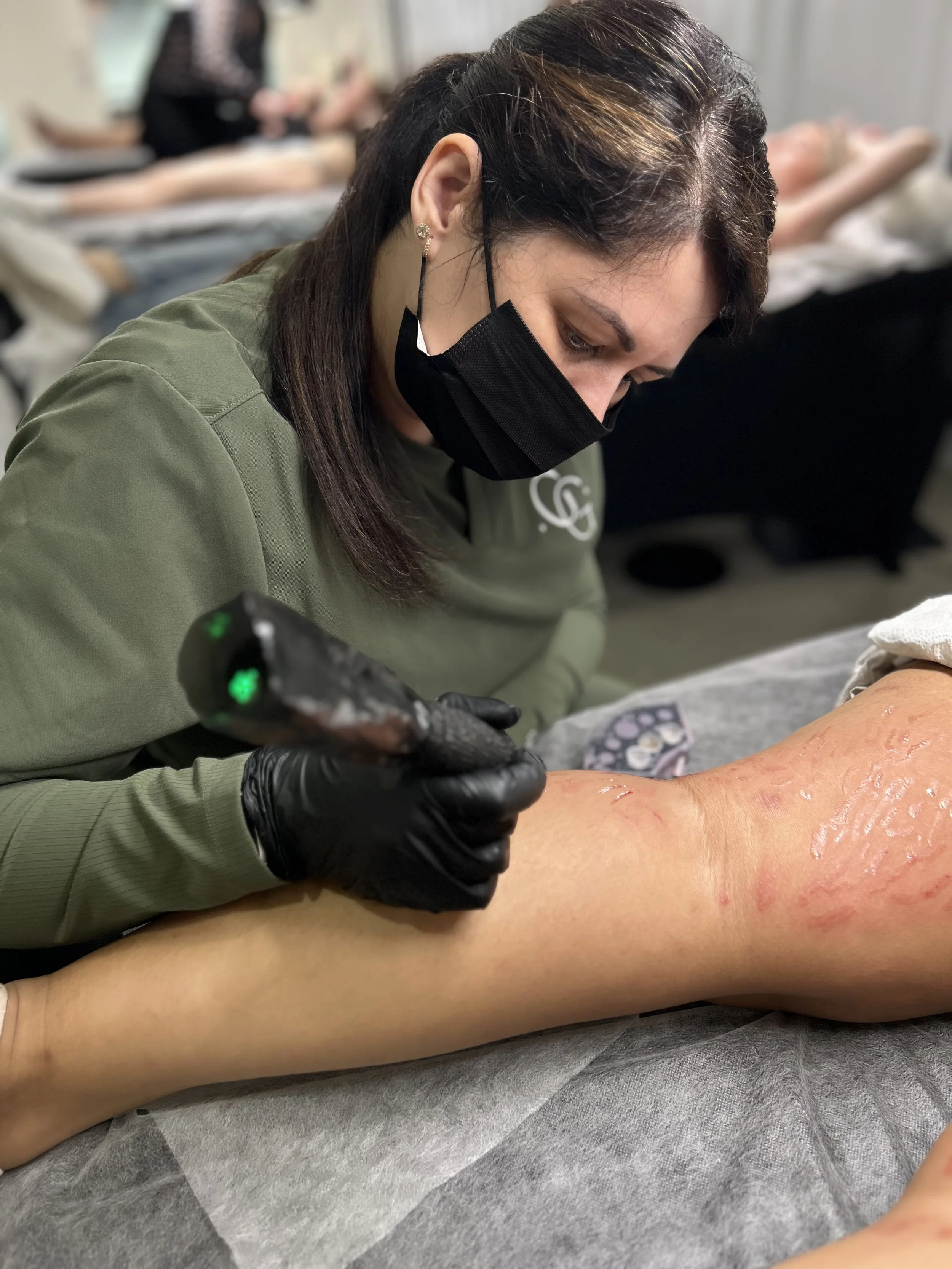 Tattoo artist wearing a black mask and gloves tattooing a leg with red scars.