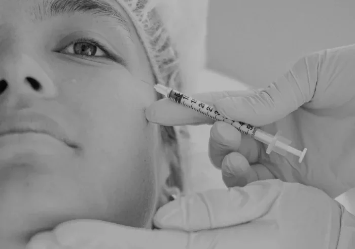 Einer Person wird eine Dosis Botox ins Gesicht injiziert, die von einem medizinischen Fachpersonal mit Handschuhen verabreicht wird.