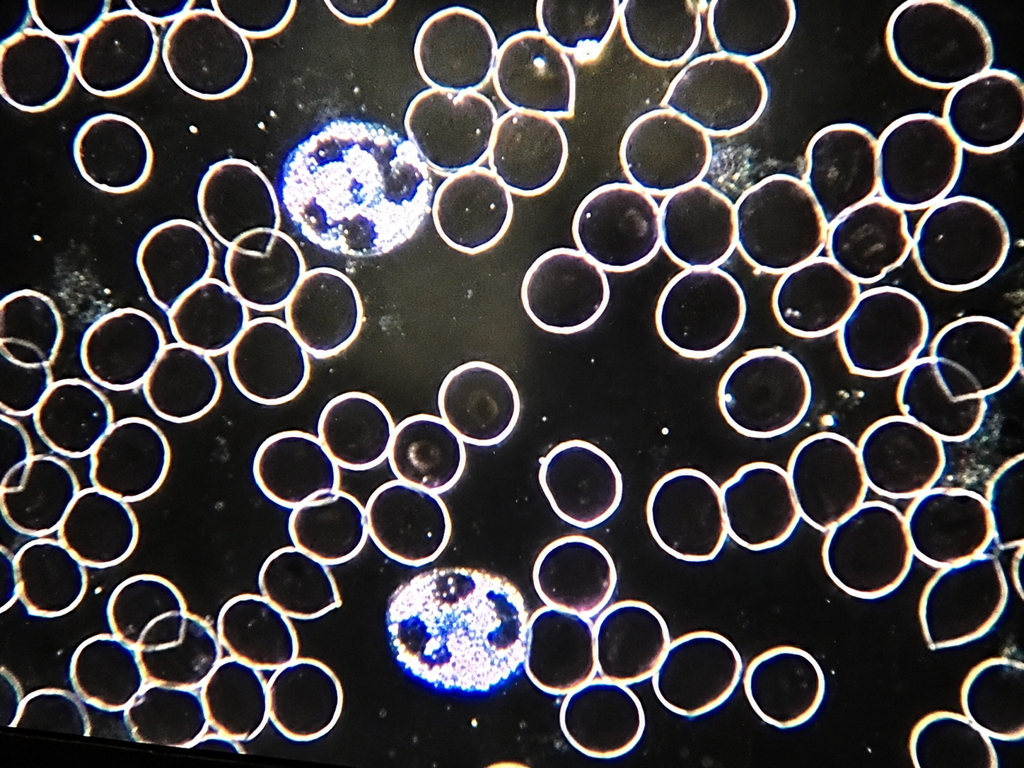Close-up image of numerous black circular particles with glowing edges, some of which contain detailed internal structures, set against a dark background.