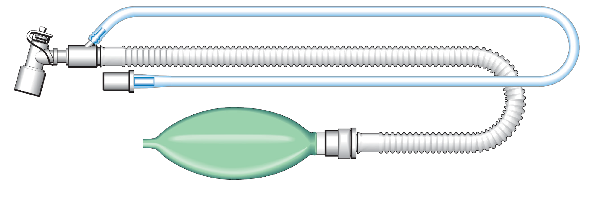 Ayers T-Piece Circuit, Jackson Rees Circuit, Anaesthesia and Resuscitation