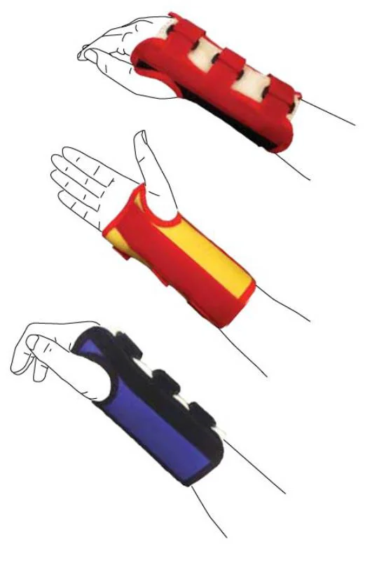 Beagle Orthopaedic D-Ring Clasby braces Meditech APAC