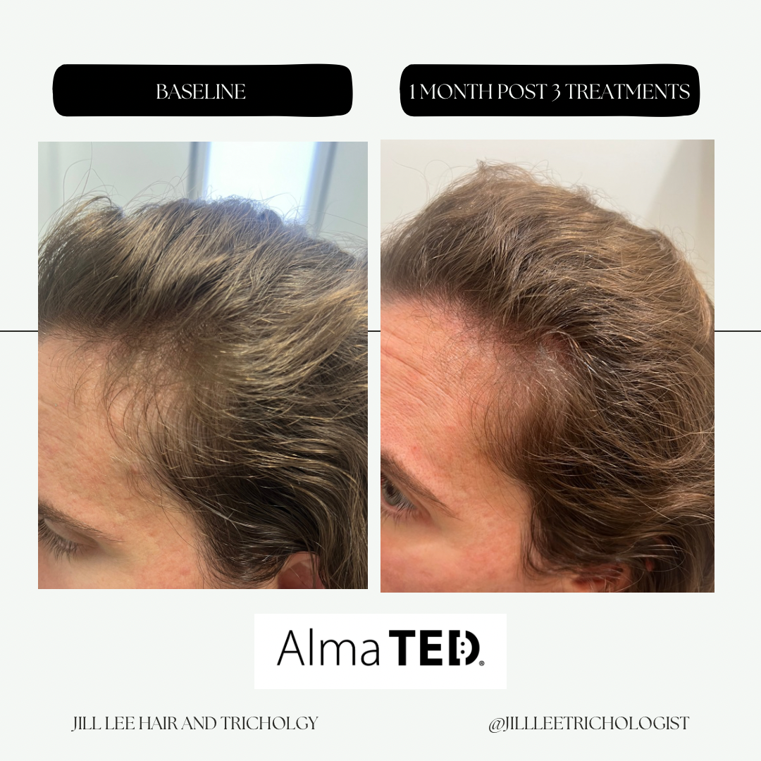 Elegant Neutral This or That Comparison Instagram Post - 5.PNG