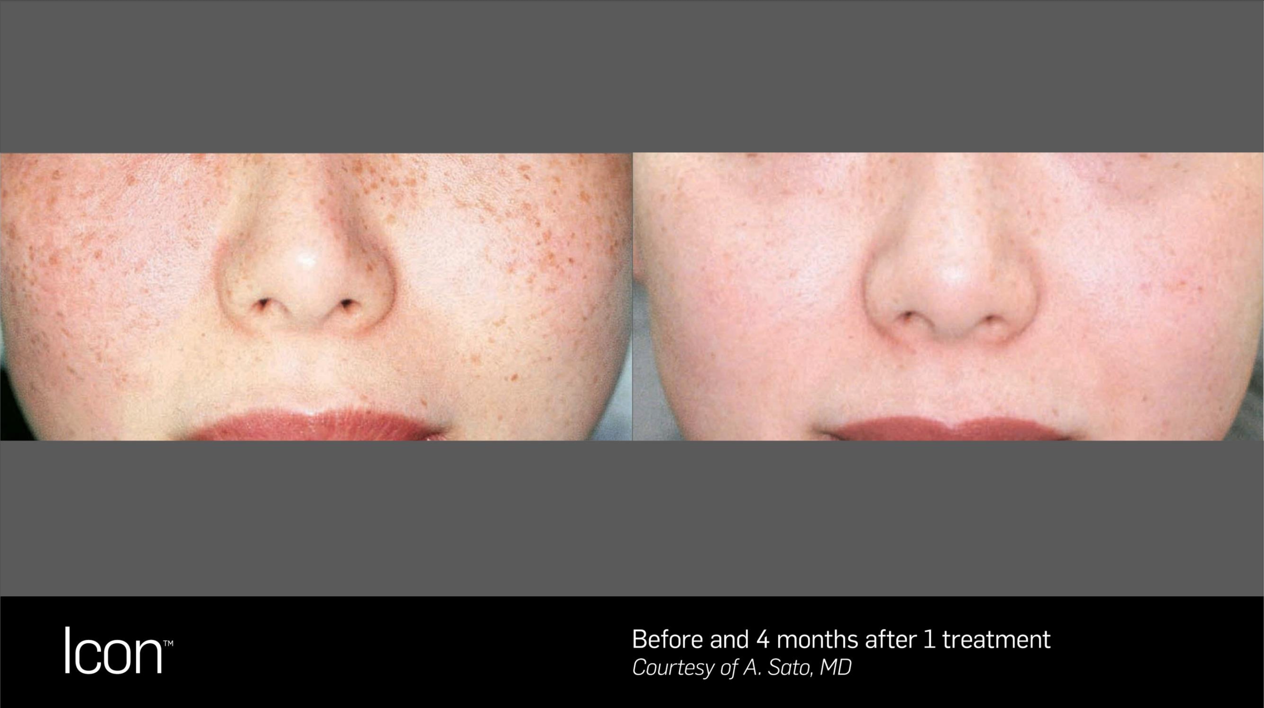 Screenshot 2025-11-30 at 6.25.17 PM.png