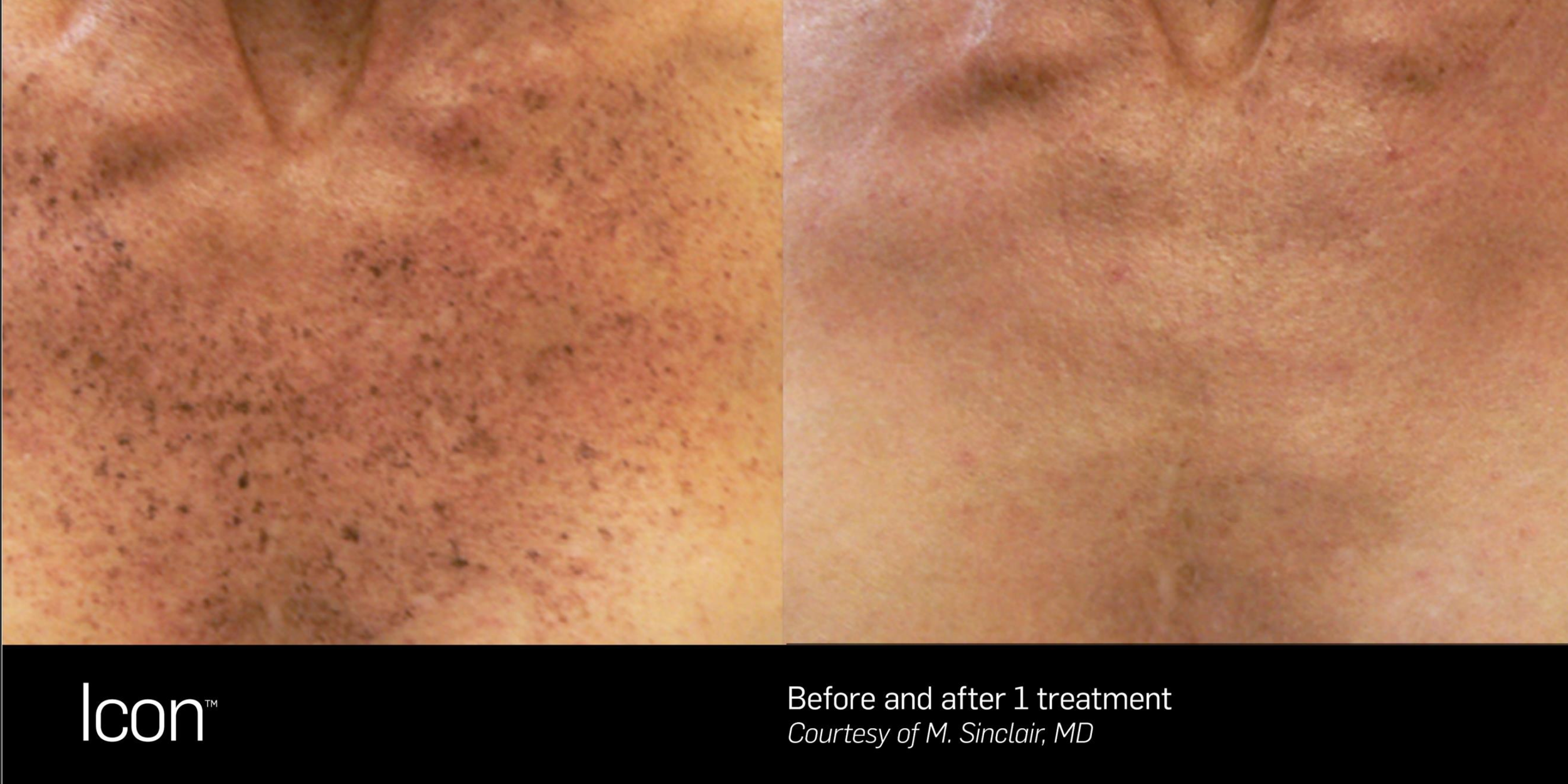 Screenshot 2025-11-30 at 6.26.33 PM.png