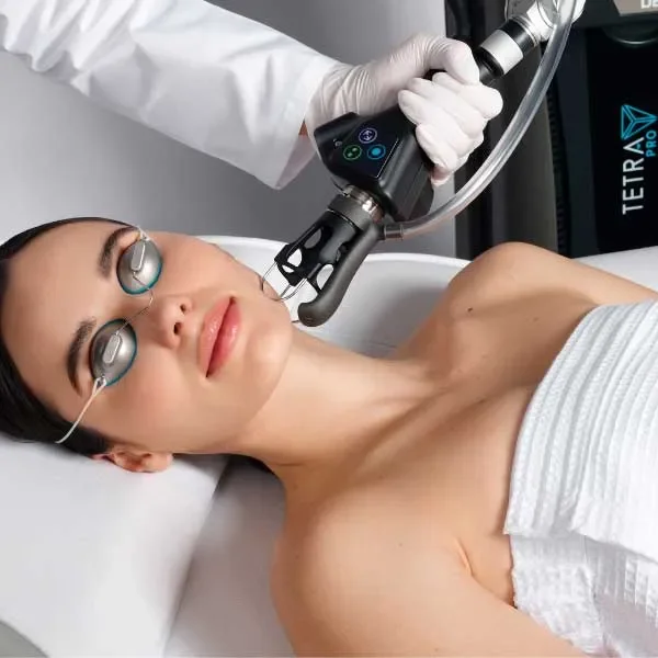 TetraPro CoolPeel Laser