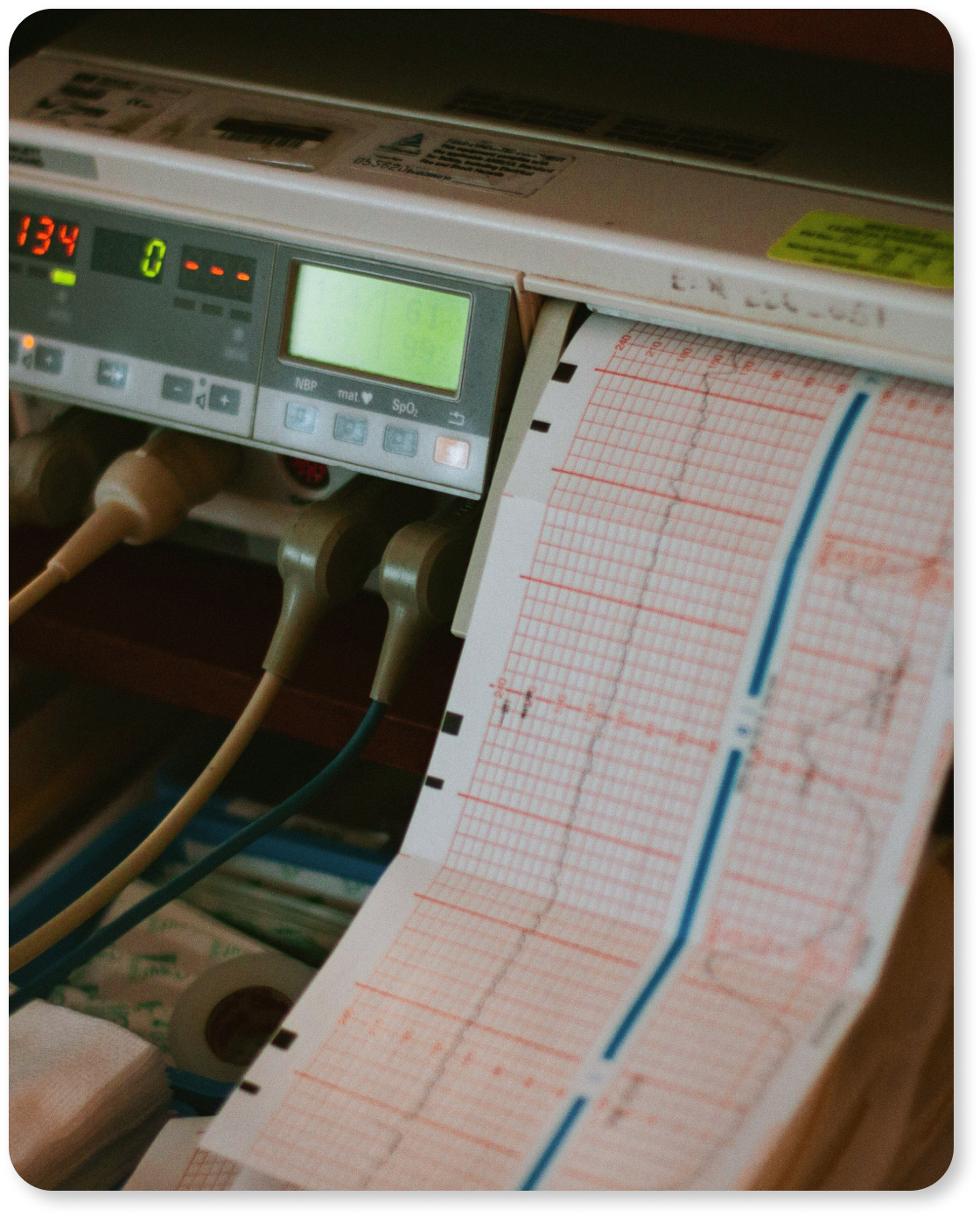 LAB CARDIO 11 (1).png