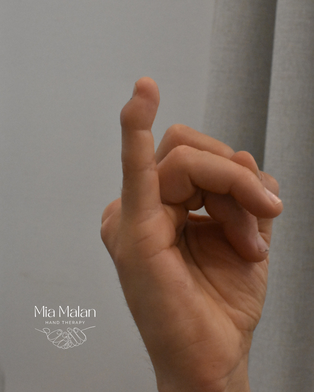 Mallet Finger: What That Drooping Fingertip Is Telling You