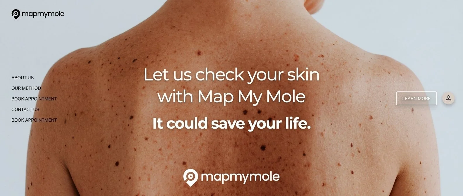 Close-up of a person's back with numerous moles and freckles as part of the website's background for comparing skin conditions.