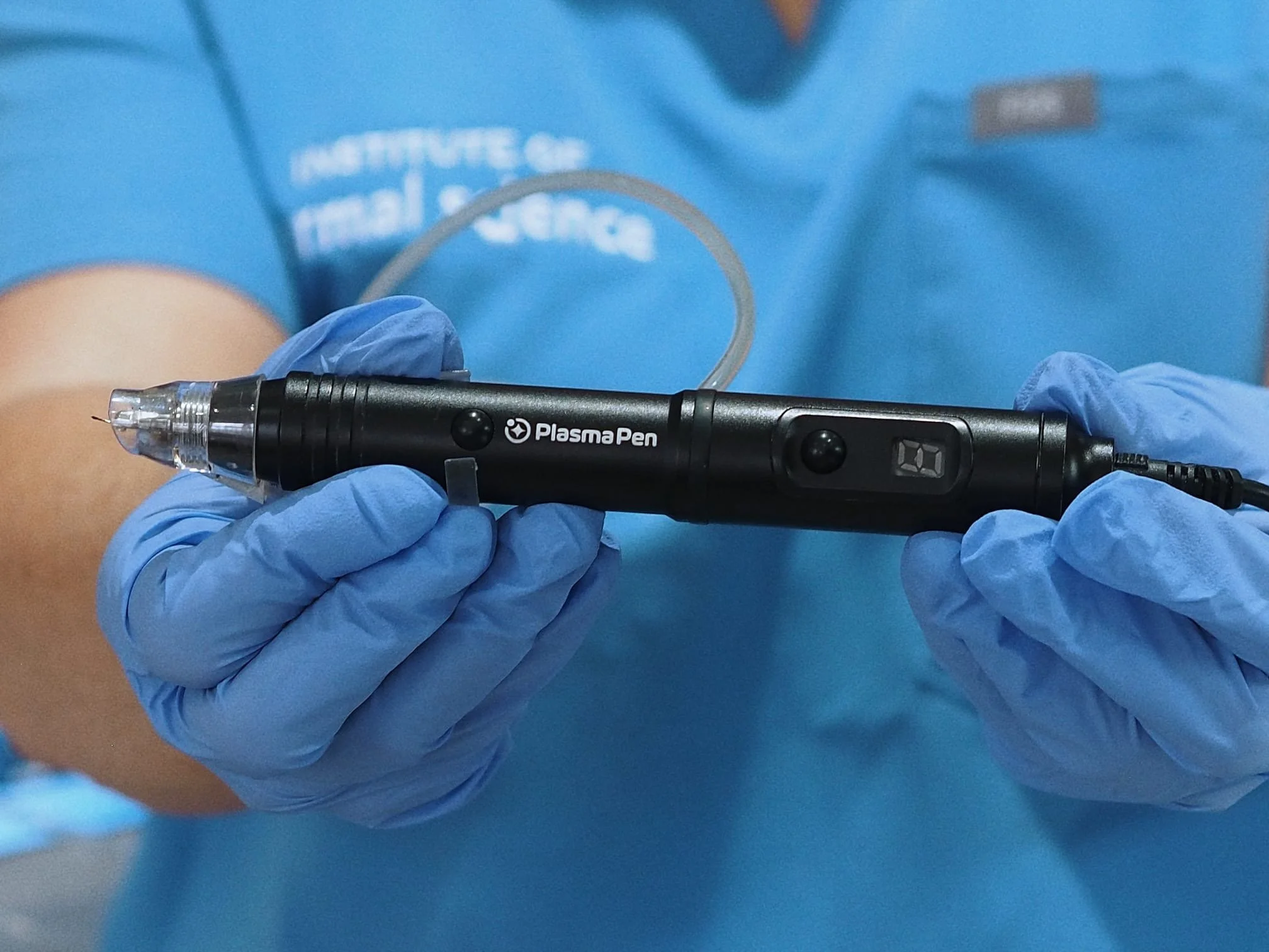 A healthcare professional wearing blue gloves holding a plasma pen, used for medical procedures, with a blurred background of blue medical scrubs.