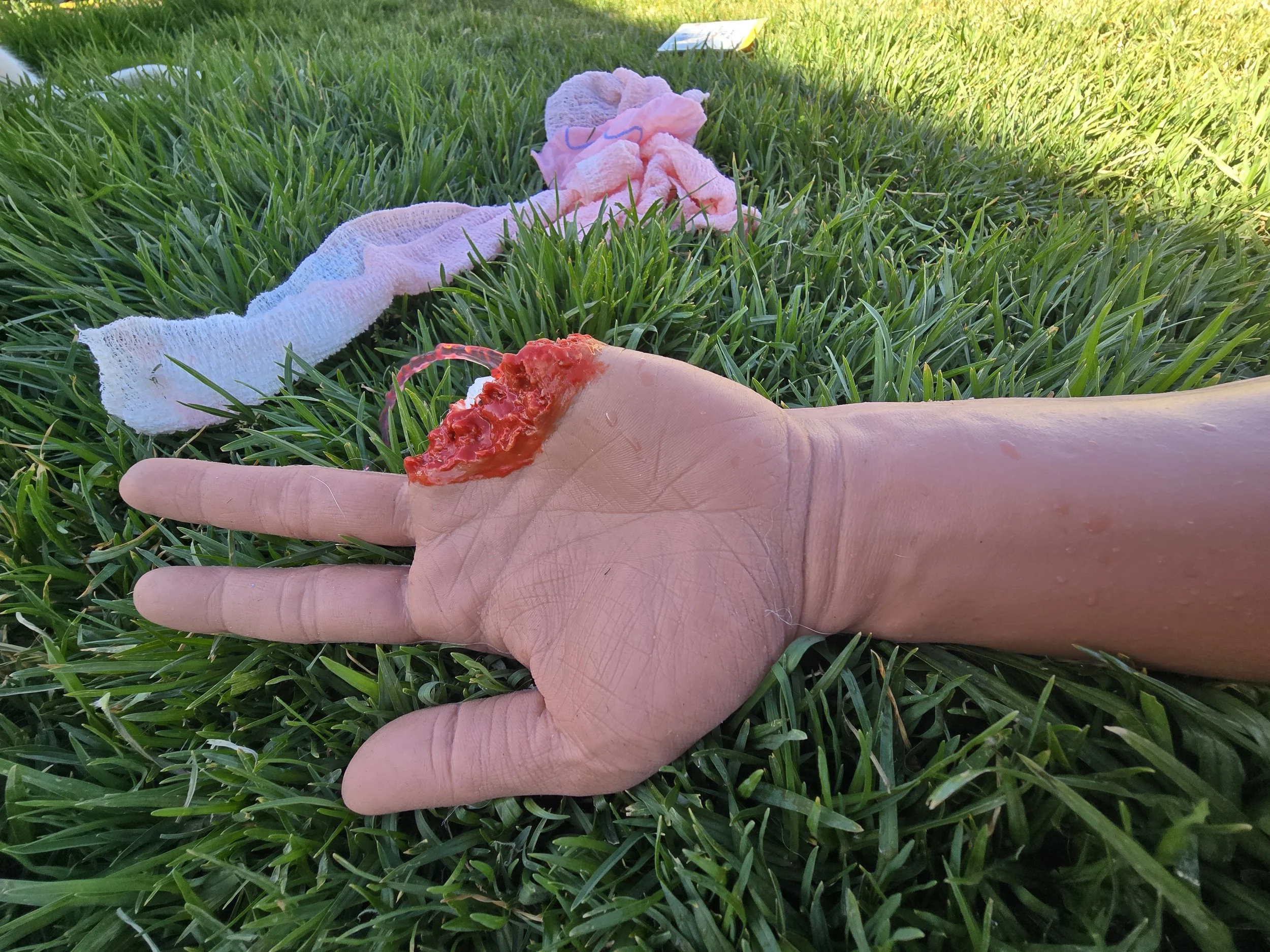 bleeding hand.jpg