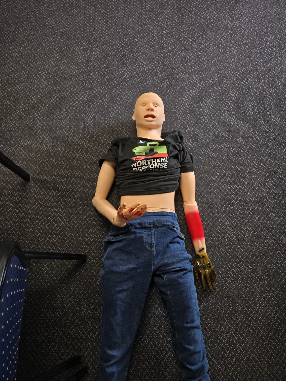 Manny the manakin showing off his 1st, 2nd and 3rd degree burns